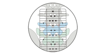 Positioning Grid Of Lumbar  Discectomy Instrument