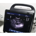 Veterinary Sonography System Es250V