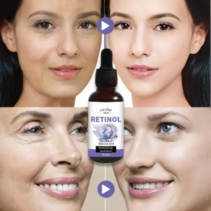 Custom Private Label Retinol Serum - Anti-Aging Wrinkle Facial Essence