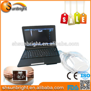 Laptop ultrasounds /ultrasound technician Medical Ultrasound Equipment