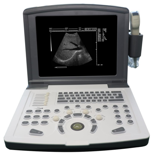 Human Ultrasound Scanner portable b ultrasound black and white ultrasound Factory