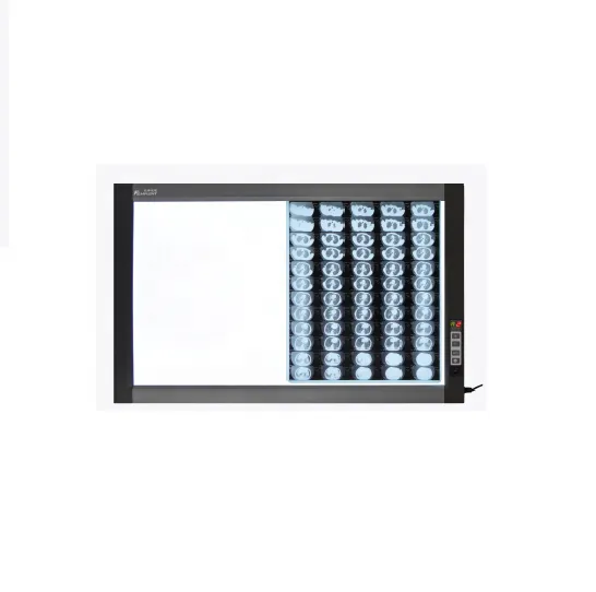 Price-Effective X-ray Imaging Solutions: LED X-ray Film Viewbox with Dual Screens for Enhanced Visualization