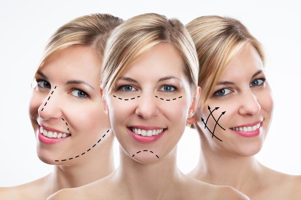 hyaluronic acid 