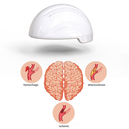 810nm Infrared Light Therapy Helmet for Alzheimer's