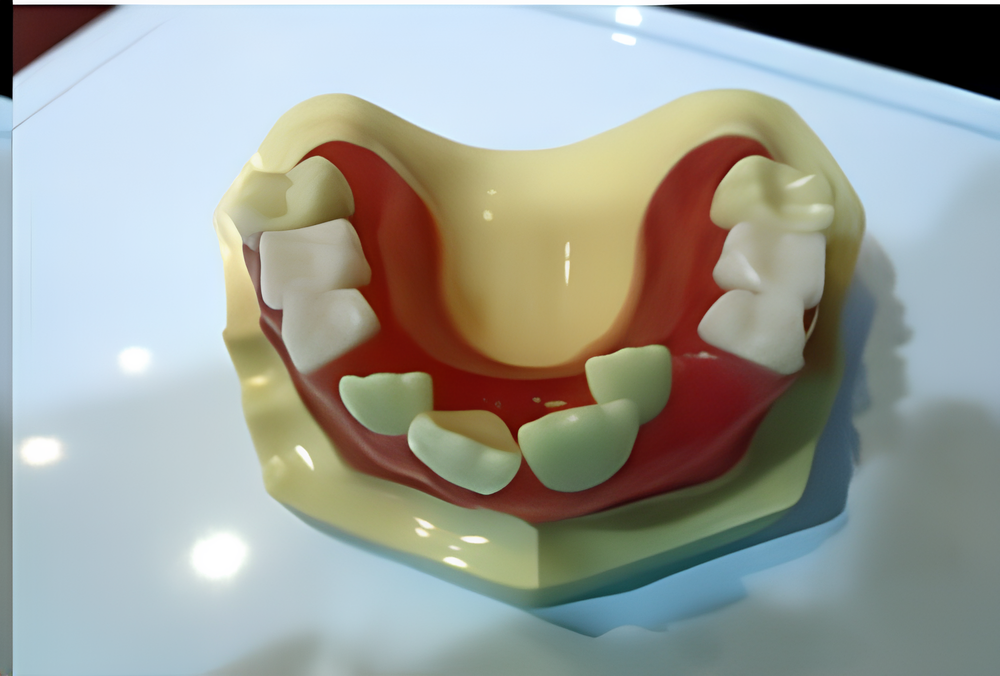 Dientes caducifolios Total de 20 dientes: 8 incisivos