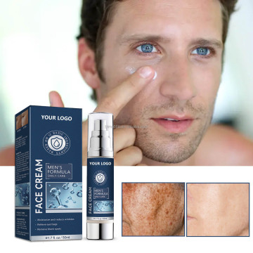 Crema sbiancante per la pelle OEM/ODM per uomini - Niacinamide nutriente e idratante acido ialuronico