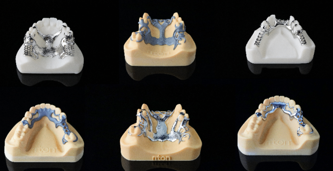 Slm Metal 3d Printing Consumables Dental Partial Fr 1 Png