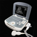 Máquina de ultrassom de laptop humano para o preço da gravidez