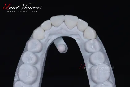 Strong zirconium oxide veneers