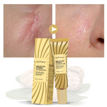 Joypretty Comprehensive Skin Care: Acne Cream, Stretch Mark Treatment, Anti-Aging, and Scar Removal Cream