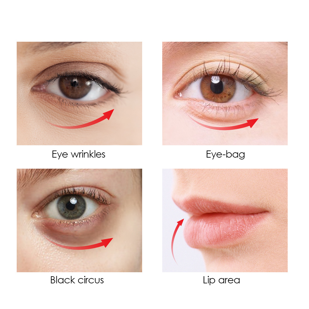 Usage of eye beauty device