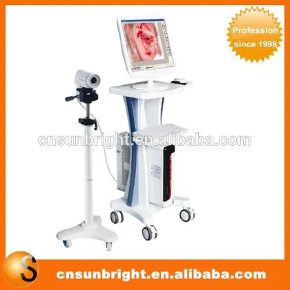 hot colposcopy equipment with trolley on sales promotion