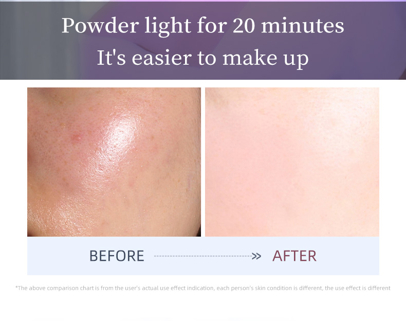 LED Face Mask 7 Light Therapy Red Light Therapy for Face _11