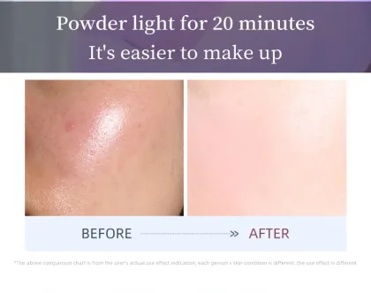 Light Therapy Facial Mask