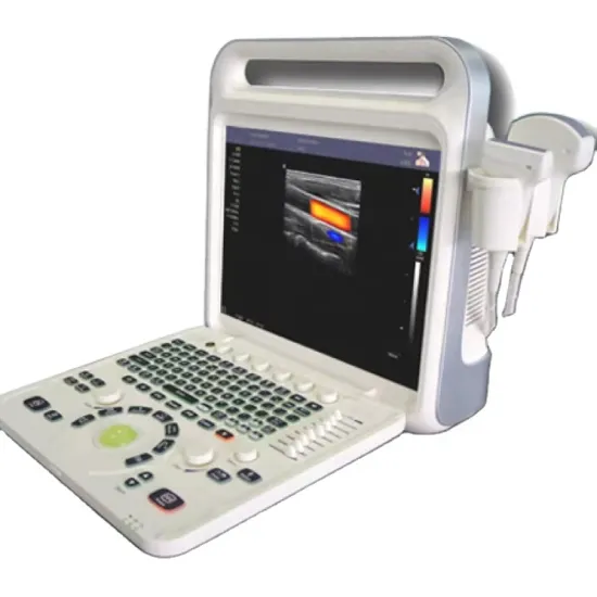 Portable Color Doppler Ultrasound Diagnostic Scanner
