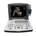 Scanner portátil B-Ultrasound com sondas de reboque