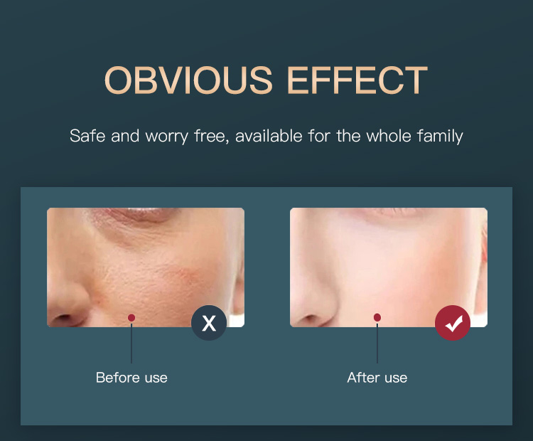 Red Light Therapy for Face LED Light Therapy(14)