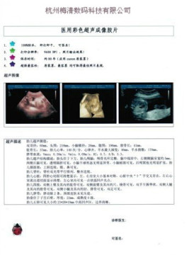 medical dry film,x-ray film,CT film