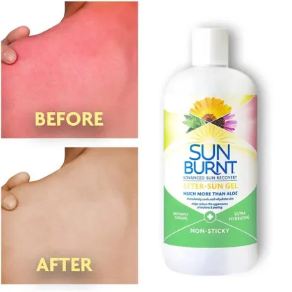 Customized After-Sun Repair Cream: Soothing, Moisturizing, and Nourishing with Vitamin C and Aloe Vera Gel