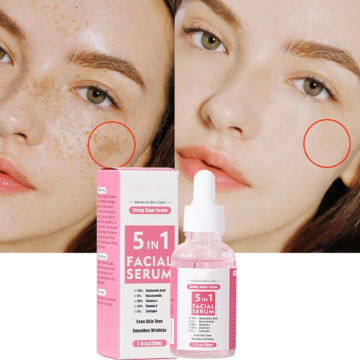Fabrik Low MOQ Wholesale 30ml 5-in-1-Gesichtsserum für gleichmäßige Hautton und Falten