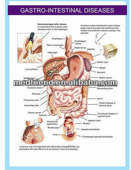 3D Medical Chart ---- Gastro-intestinal Disease