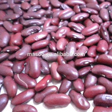 Ethiopian Dark Red Kidney Beans(English type)