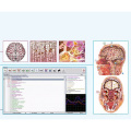 oberon biofeedback NLS oftware metatron diagnostische machine