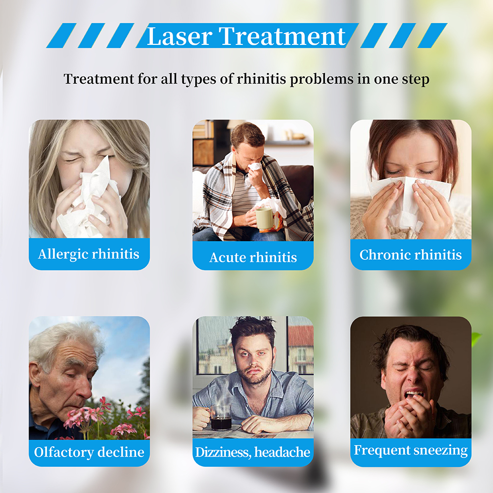 rhinitis treatment machine nasal laser probes red light laser therapy