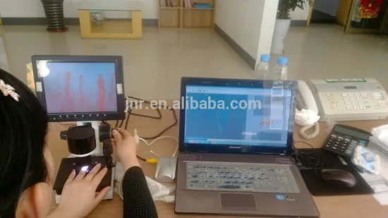 USB Computer Capillaroscope Microcirculation Microscope