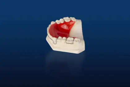Types of Removable Orthodontic Appliances