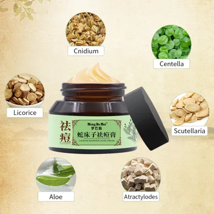 Gentle Facial Anti Acne Treatment Acne Cream