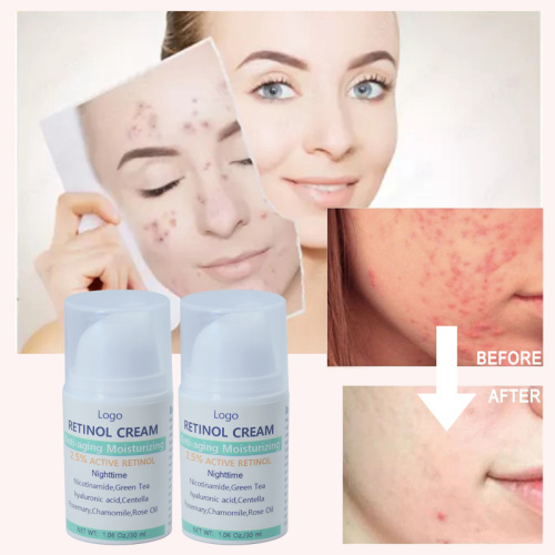 Crème pour les cicatrices d&#39;acné Pimple Dark Spot Remover