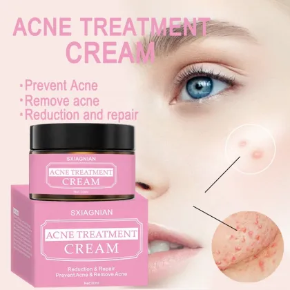 pimple cream for men acne cream