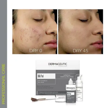 Dermaceutic Milk peel Sour brush acid Rejuvenation