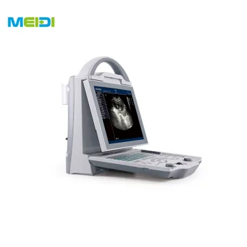 Portable 3D/4D Color Doppler Ultrasound Machine Digital Ultrasonic Diagnosis System for Human Use Medical Ultrasound Instruments
