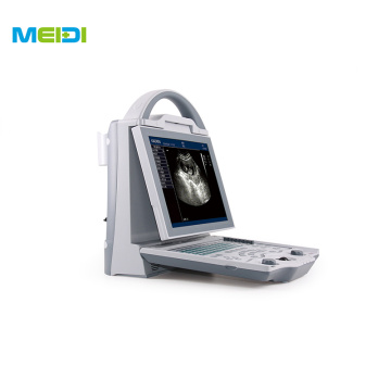 Portable 3D/4D Color Doppler Ultrasound Machine Digital Ultrasonic Diagnosis System for Human Use Medical Ultrasound Instruments