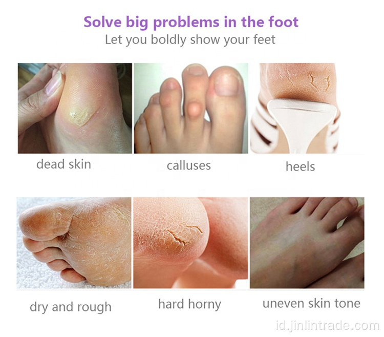 OEM Exfoliating Mengupas Perawatan Kaus Kaki Kaki