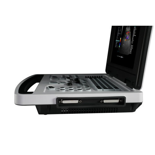 Notebook Color Doppler Ultrasound Scanner