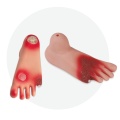 Diabetic Foot Anatomy Model