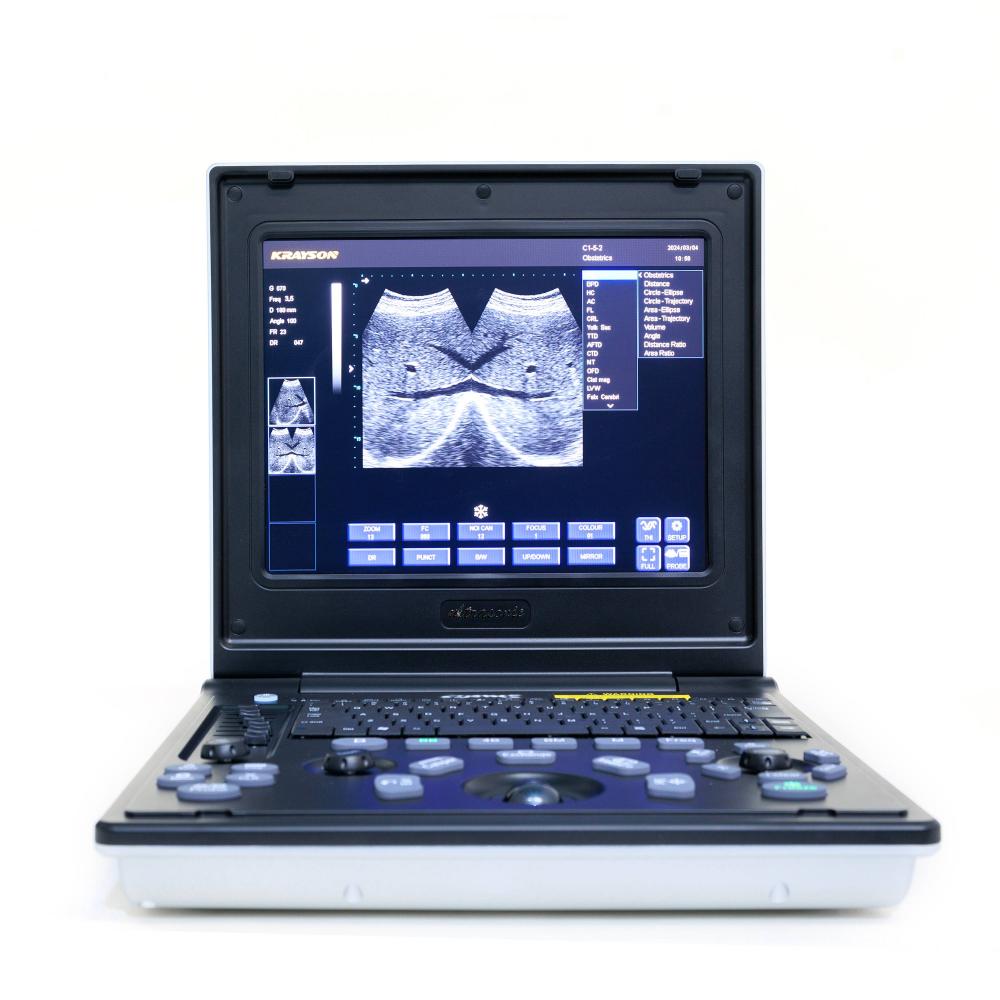 Laptop Ultrasound