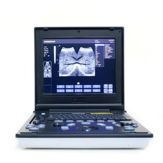 veterinary ultrasound scanner for lion cat liver