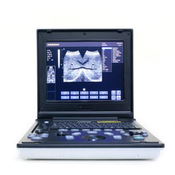 Laptop ultrasound instrument for livers of Maine cats