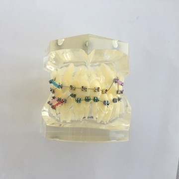 Orthodontic Treatment Models Search Engine