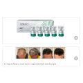 SCE+ HRLV EXOSOMES FOR HAIR RESTORATION