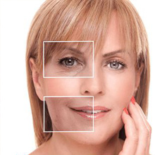 Gel dermique PLLA de qualité médicale utilisée pour le visage