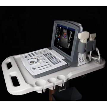 Máquina de ultrasonido barato Color Doppler para el embarazo