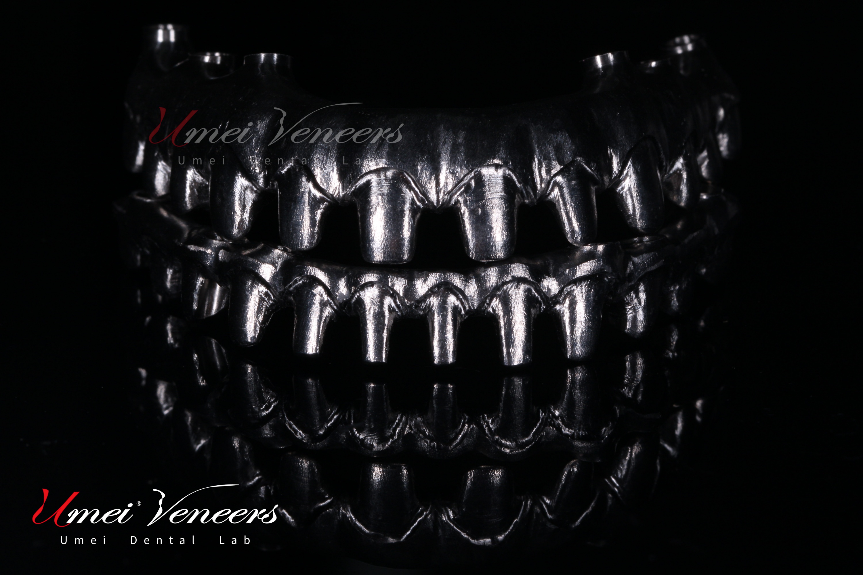 Full Arch Zirconia Implant Bridge