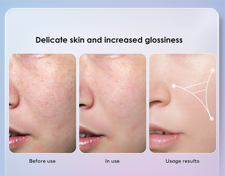 red light phototherapy