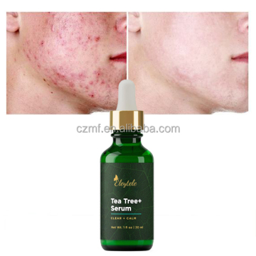 OEM ODM Skin Care Serum: Tea Tree Hydrating Anti-Aging Whitening Vitamin C Glycolic Acid Nicotinamide for Face