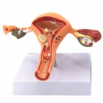 2025 New KRC Medical Anatomical Human Uterus Model